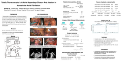 Thumbnail for Totally Thoracoscopic Left Atrial Appendage Closure And Ablation In Nonvalvular Atrial Fibrillation
