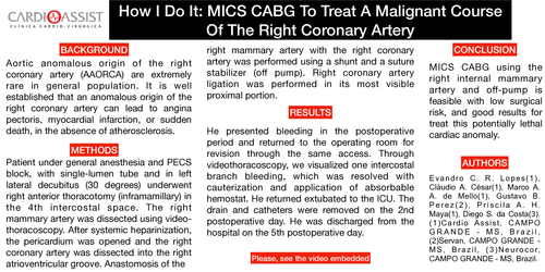 Preview of How I Do It: MICS CABG To Treat A Malignant Course Of The Right Coronary Artery
