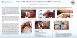 Thumbnail for How To Successfully Perform Minimally Invasive Cardiac Surgery In A Resource Limited Setting