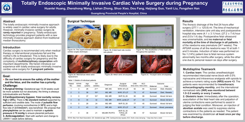 Preview of Totally Thoracoscopic Cardiac Valve Surgery Of Pregnancy