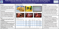 Thumbnail for Totally Thoracoscopic Cardiac Valve Surgery Of Pregnancy