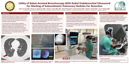 Preview of Utility Of Robot-assisted Bronchoscopy With Radial Endobronchial Ultrasound For Marking Of Subcentimeter Pulmonary Nodules For Resection
