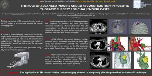 Preview of The Role Of Advanced Imagine And 3d Reconstruction In Robotic Thoracic Surgery For Challenging Cases