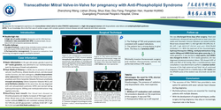 Thumbnail for Transcatheter Mitral Valve-in-valve For Pregnancy With Anti-phospholipid Syndrome