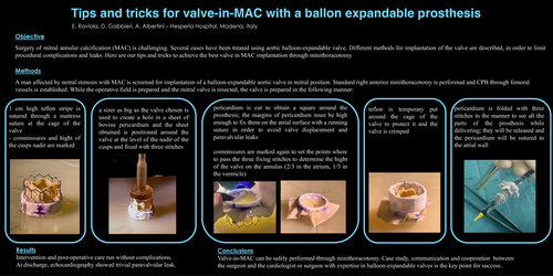Preview of Tips And Tricks For Valve In MAC With A Ballon Expandable Prosthesis