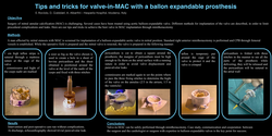 Thumbnail for Tips And Tricks For Valve In MAC With A Ballon Expandable Prosthesis