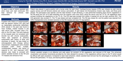 Thumbnail for Robotic Assisted Right Atrial Mass And Implantable Cardioverter Defibrillator Lead Removal