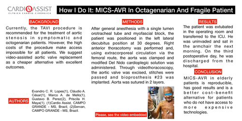 Preview of How I Do It: MICS-AVR In Octagenarian And Fragile Patient