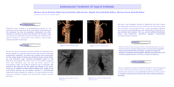 Thumbnail for Endovascular Treatment Of Type IA Endoleak