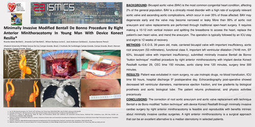 Preview of Minimally Invasive Modified Bentall De Bonno By Right Anterior Minithoracotomy In Young Man With Device Konect Resilia®