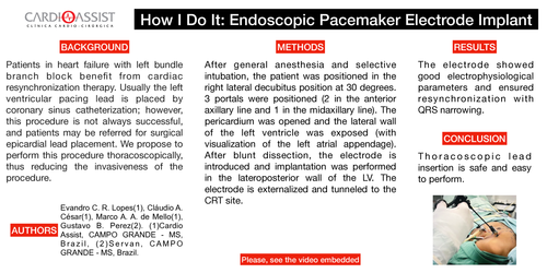 Preview of How I Do It: Endoscopic Pacemaker Electrode Implant
