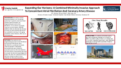 Thumbnail for Expanding Our Horizons: A Combined Minimally Invasive Approach To Concomitant Atrial Fibrillation And Coronary Artery Disease