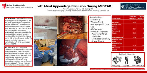 Preview of Left Atrial Appendage Exclusion During MIDCAB