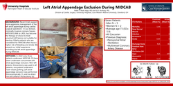 Thumbnail for Left Atrial Appendage Exclusion During MIDCAB
