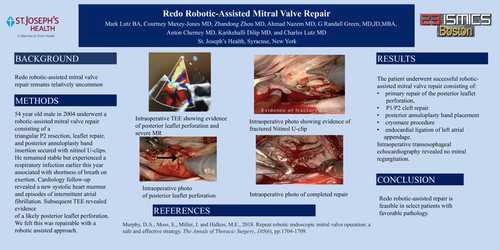Preview of Redo Robotic-Assisted Mitral Valve Repair