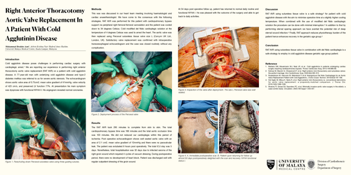 Preview of Right Anterior Thoracotomy Aortic Valve Replacement In A Patient With Cold Agglutinin Disease