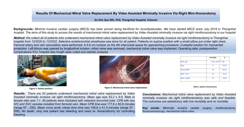 Preview of The Results Of Mechanical Mitral Valve Replacement By Video Assisted Minimally Invasive Via Right Mini-thoracotomy