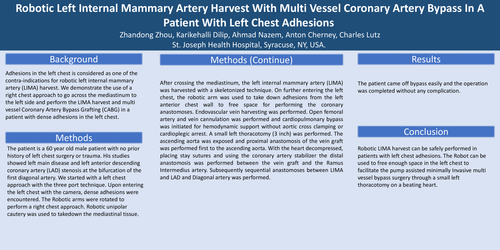 Preview of Robotic Left Internal Mammary Artery Harvest With Multi Vessel Coronary Artery Bypass In A Patient With Left Chest Adhesions
