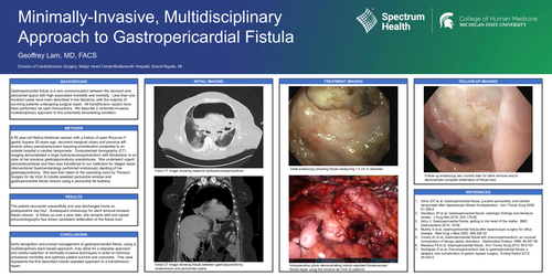 Preview of Minimally-invasive, Multidisciplinary Approach To Gastropericardial Fistula
