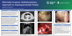 Thumbnail for Minimally-invasive, Multidisciplinary Approach To Gastropericardial Fistula