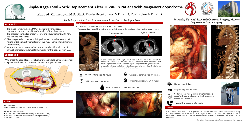 Thumbnail for Single-stage Total Aortic Replacement After Tevar In Patient With Mega-aortic Syndrome