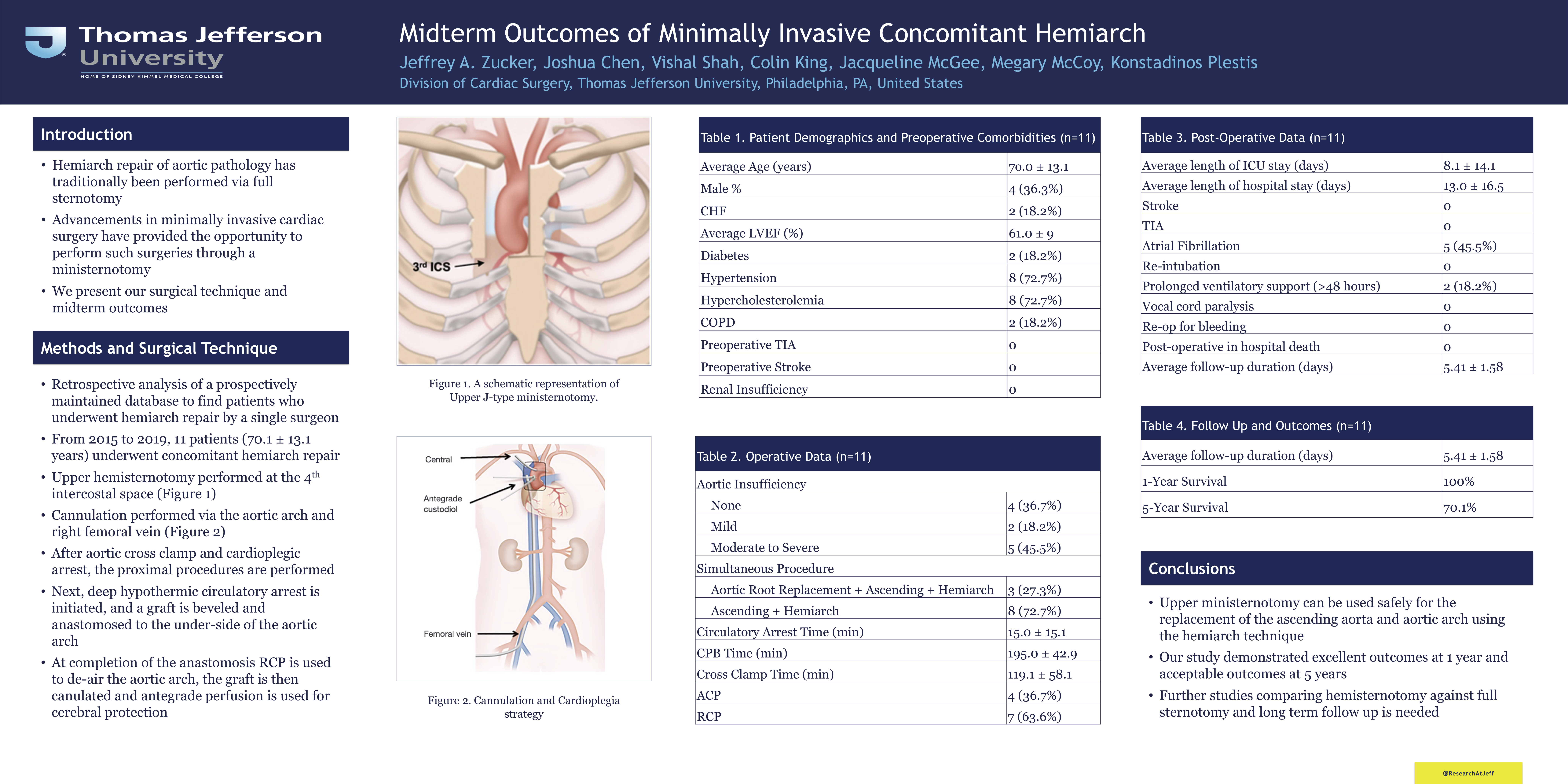 Preview of Midterm Outcomes Of Minimally Invasive Concomitant Hemiarch