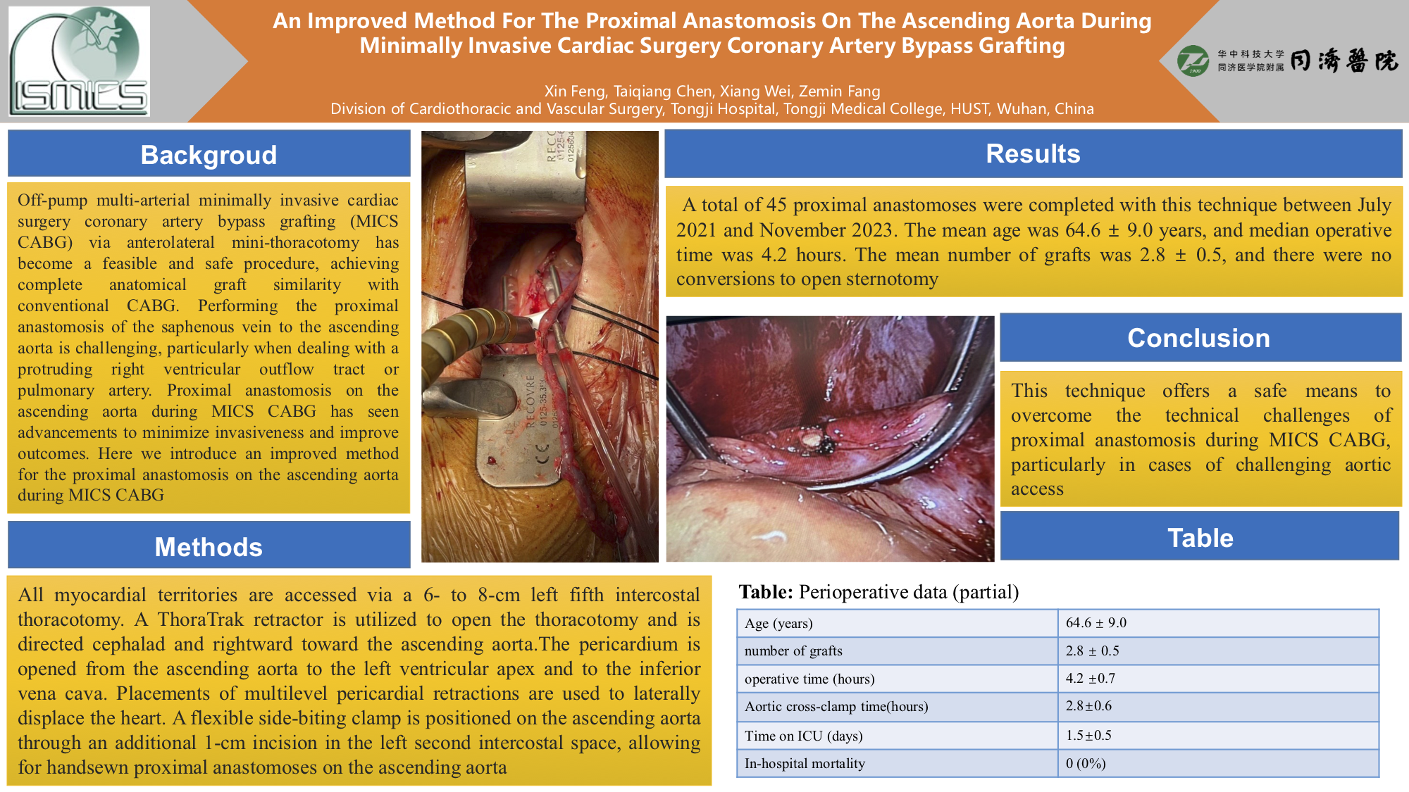 Thumbnail for An Improved Method For The Proximal Anastomosis On The Ascending Aorta During Minimally Invasive Cardiac Surgery Coronary Artery Bypass Grafting