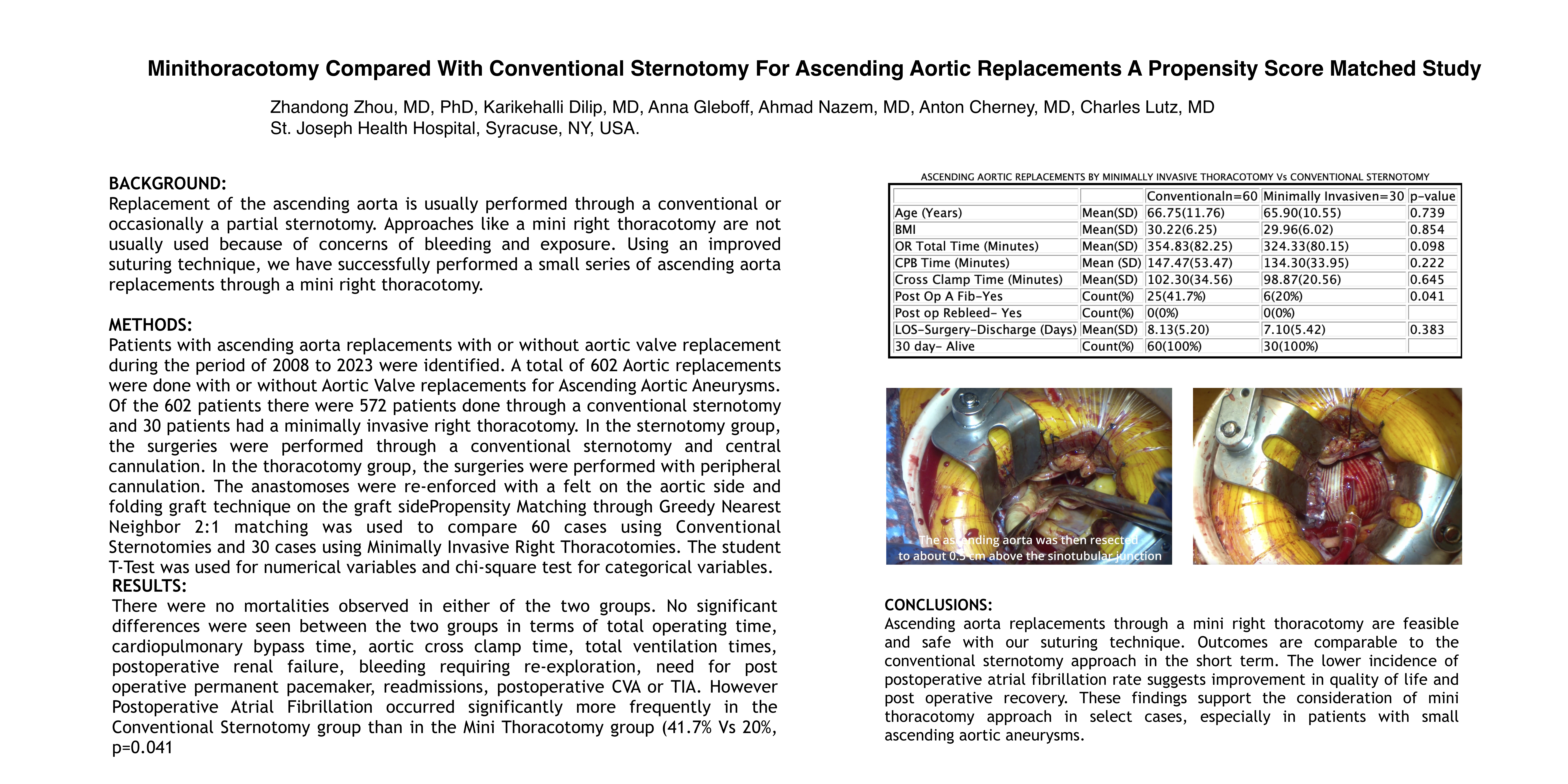 Preview of Minithoracotomy Compared With Conventional Sternotomy For Ascending Aortic Replacements A Propensity Score Matched Study