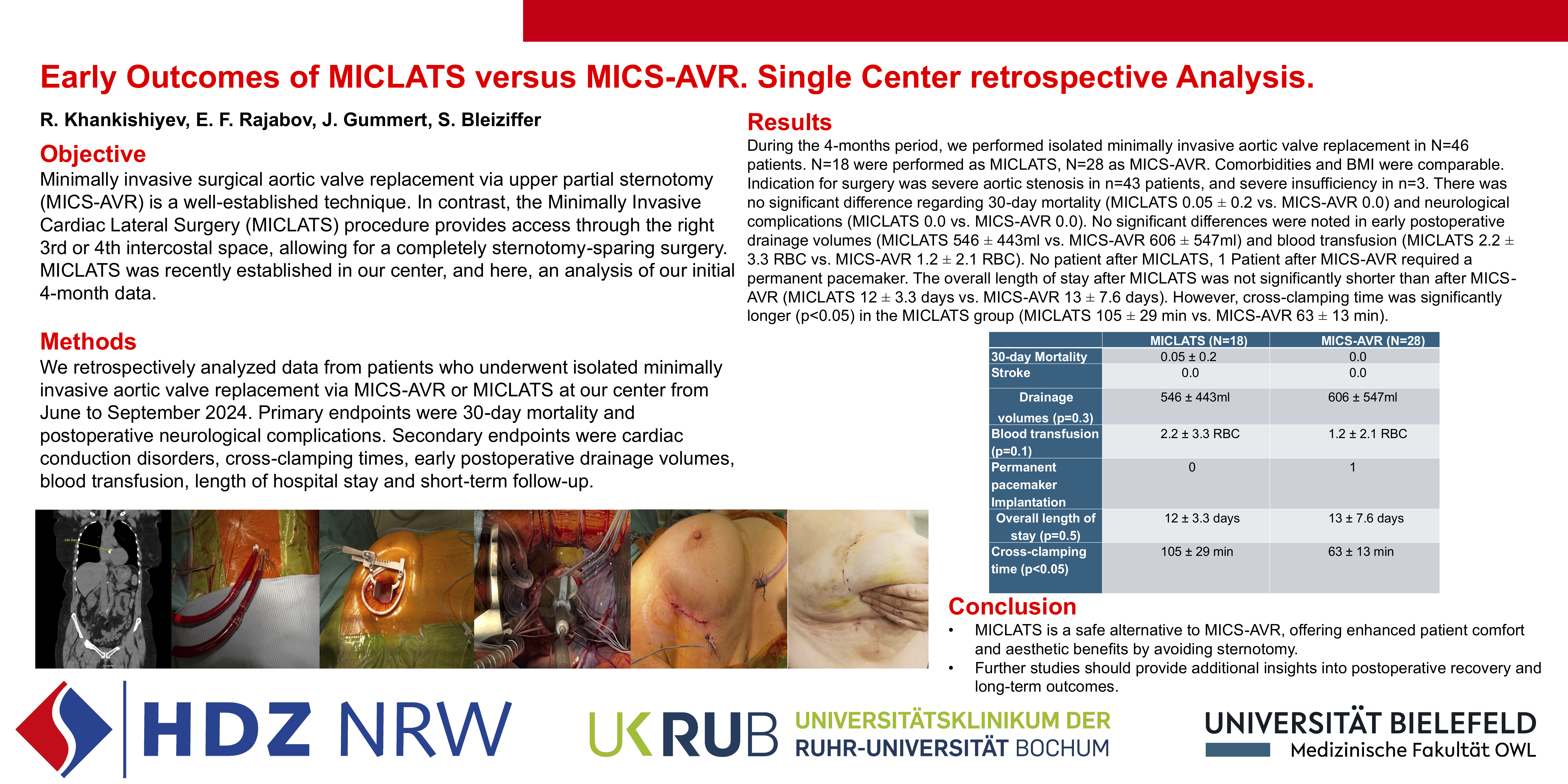 Preview of Miclats With Sutured Valve