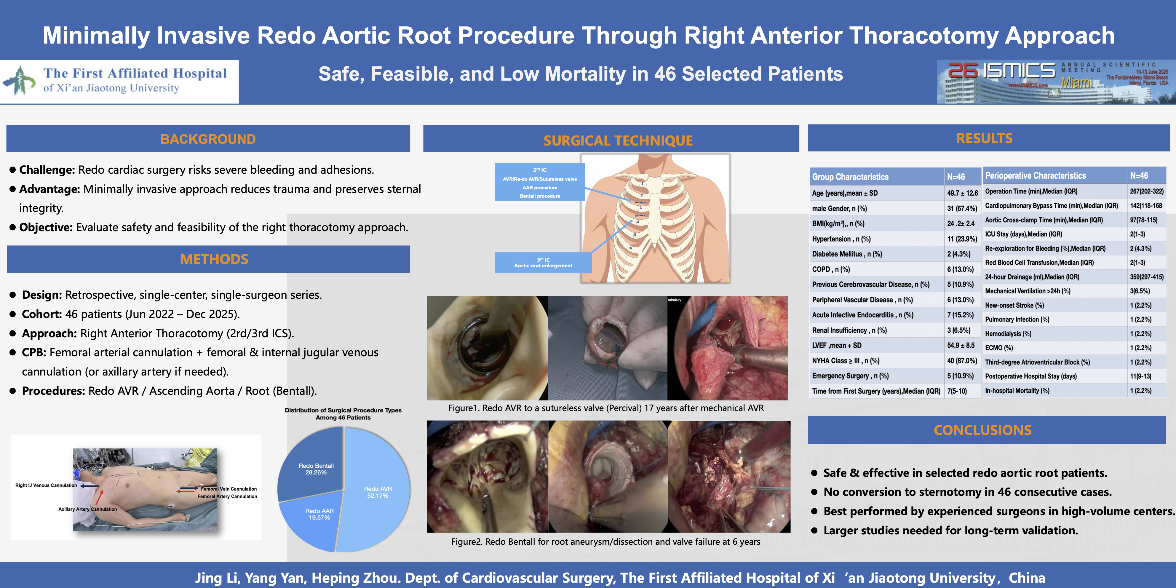 Thumbnail for Minimally Invasive Redo Aortic Root Procedure Through Right Anterior Thoracotomy Approach