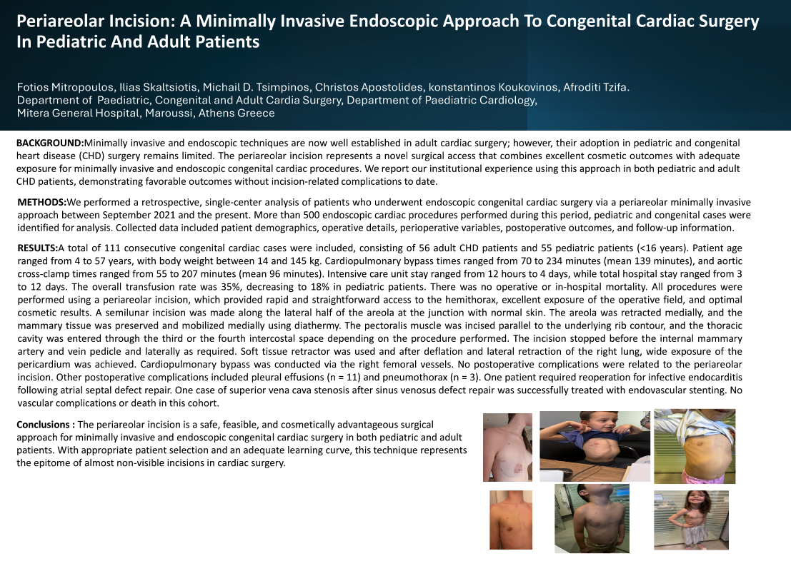 Thumbnail for Periareolar Incision: A Minimally Invasive Endoscopic Approach To Congenital Cardiac Surgery In Pediatric And Adult Patients