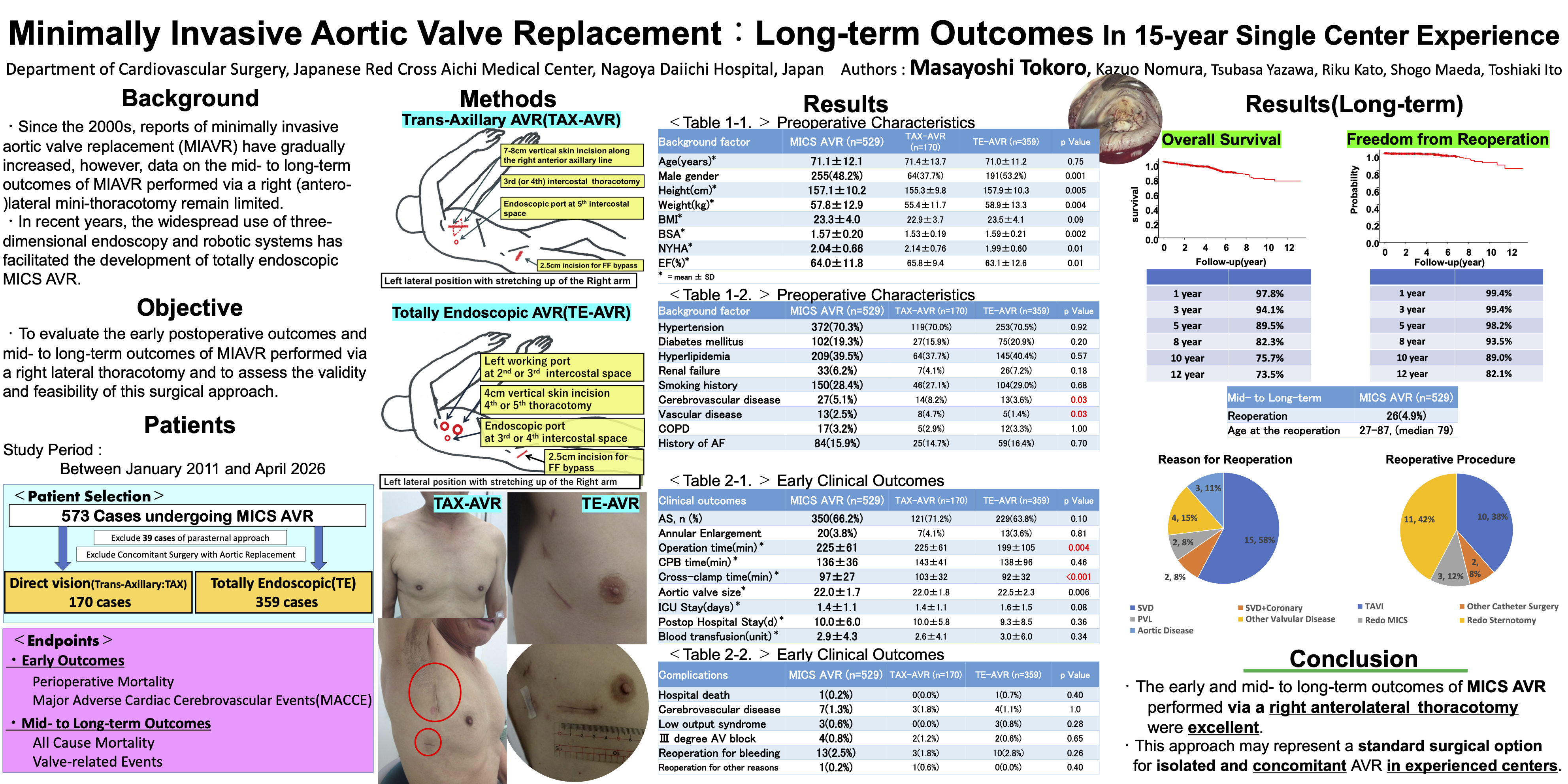 Thumbnail for Minimally Invasive Aortic Valve Replacement : Long-term Outcomes In 15-year Single Center Experience
