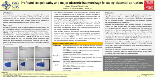 Preview of Severe obstetric coagulopathy following placental abruption requiring 18 g fibrinogen concentrate.