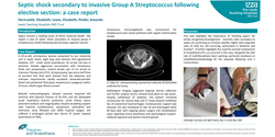 Thumbnail for Septic shock secondary to invasive Group A Streptococcus following elective section: a case report.