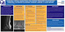 Thumbnail for Subdural spinal haematoma following presumed inadvertent subdural catheter placement during labour: a case report