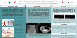 Thumbnail for Effect of external aortic compression on contrast distribution below the compressed area in an experimental pig model