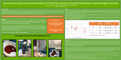 Thumbnail for Assessing accuracy of visual estimation of blood loss during simulated postpartum haemorrhage scenarios.