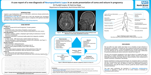 Preview of A case report of a new diagnosis of neuropsychiatric lupus in an acute presentation of coma and seizure in pregnancy