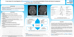 Thumbnail for A case report of a new diagnosis of neuropsychiatric lupus in an acute presentation of coma and seizure in pregnancy