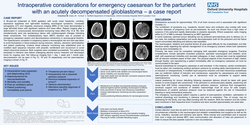 Thumbnail for Management of emergency caesarean delivery and decompressive craniectomy for parturient with an acutely decompensated glioblastoma