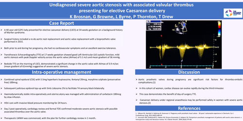 Preview of Undiagnosed severe aortic stenosis with associated valvular thrombus presenting for elective caesarean delivery