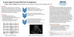 Thumbnail for A case report of acute fatty liver in pregnancy