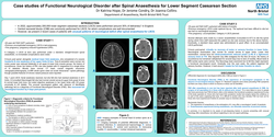 Thumbnail for Case reports of functional neurological disorder after spinal anaesthesia for lower segment caesarean section