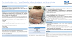 Thumbnail for A fungal rash and its implications for spinal anaesthesia in labour
