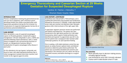 Thumbnail for Emergency thoracotomy and caesarian section at 29 weeks gestation for suspected oesophageal rupture