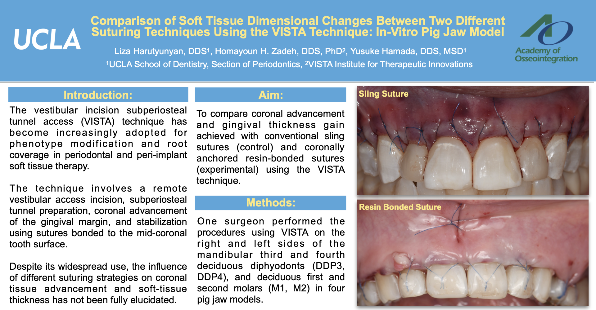 Thumbnail for Comparison of Soft Tissue Dimensional Changes Between Two Different Suturing Techniques Using the VISTA Technique: In-Vitro Pig Jaw Model