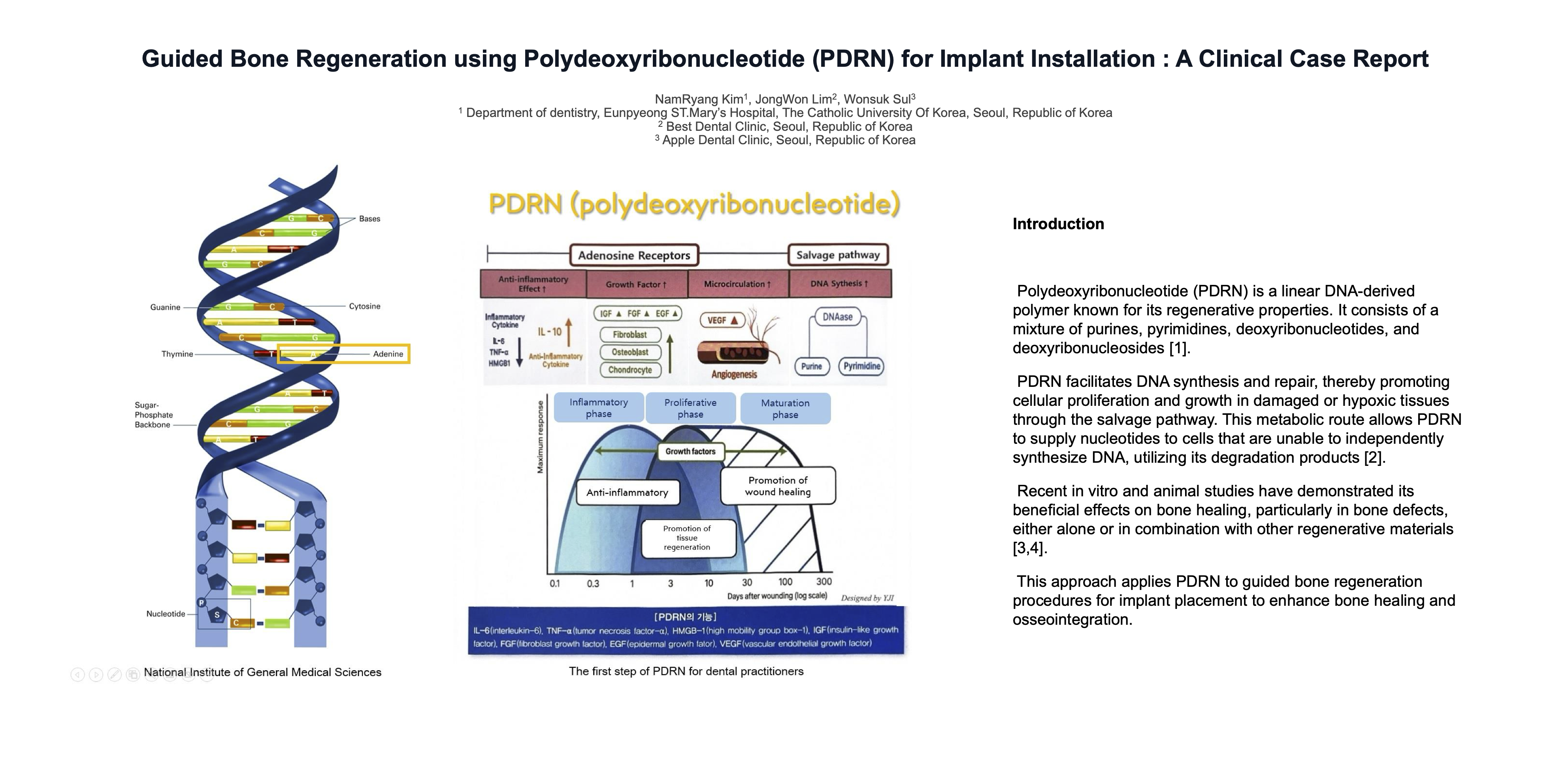 Thumbnail for Guided Bone Regeneration using Polydeoxyribonucleotide (PDRN) for Implant Installation: A Clinical Case Report