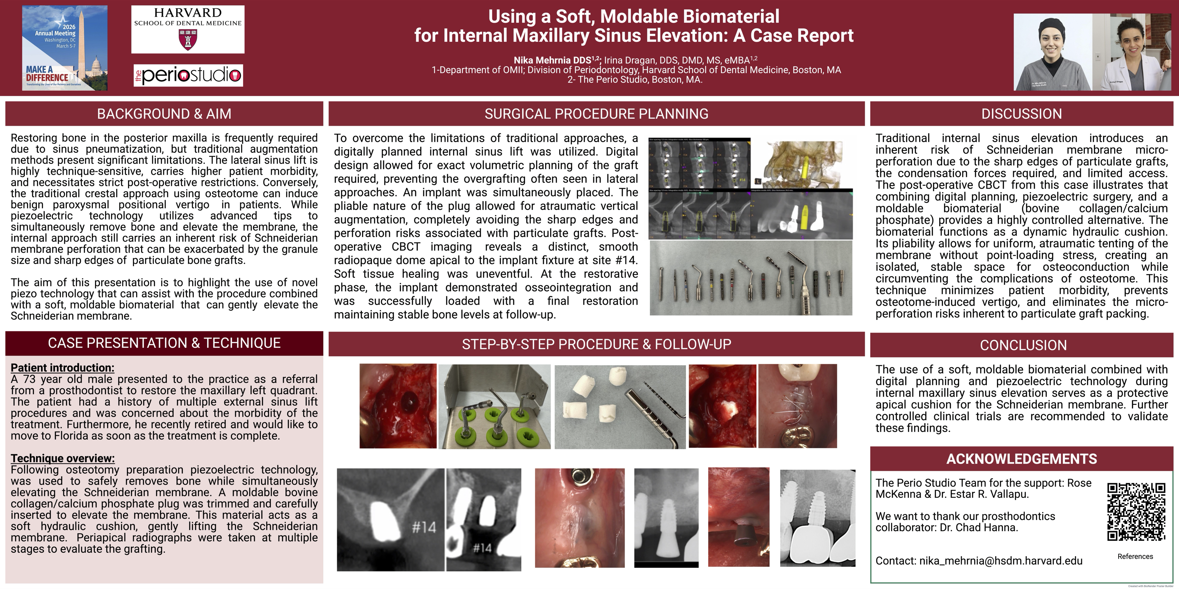 Thumbnail for Using a Soft, Moldable Biomaterial for Internal Maxillary Sinus Elevation: A Case Report