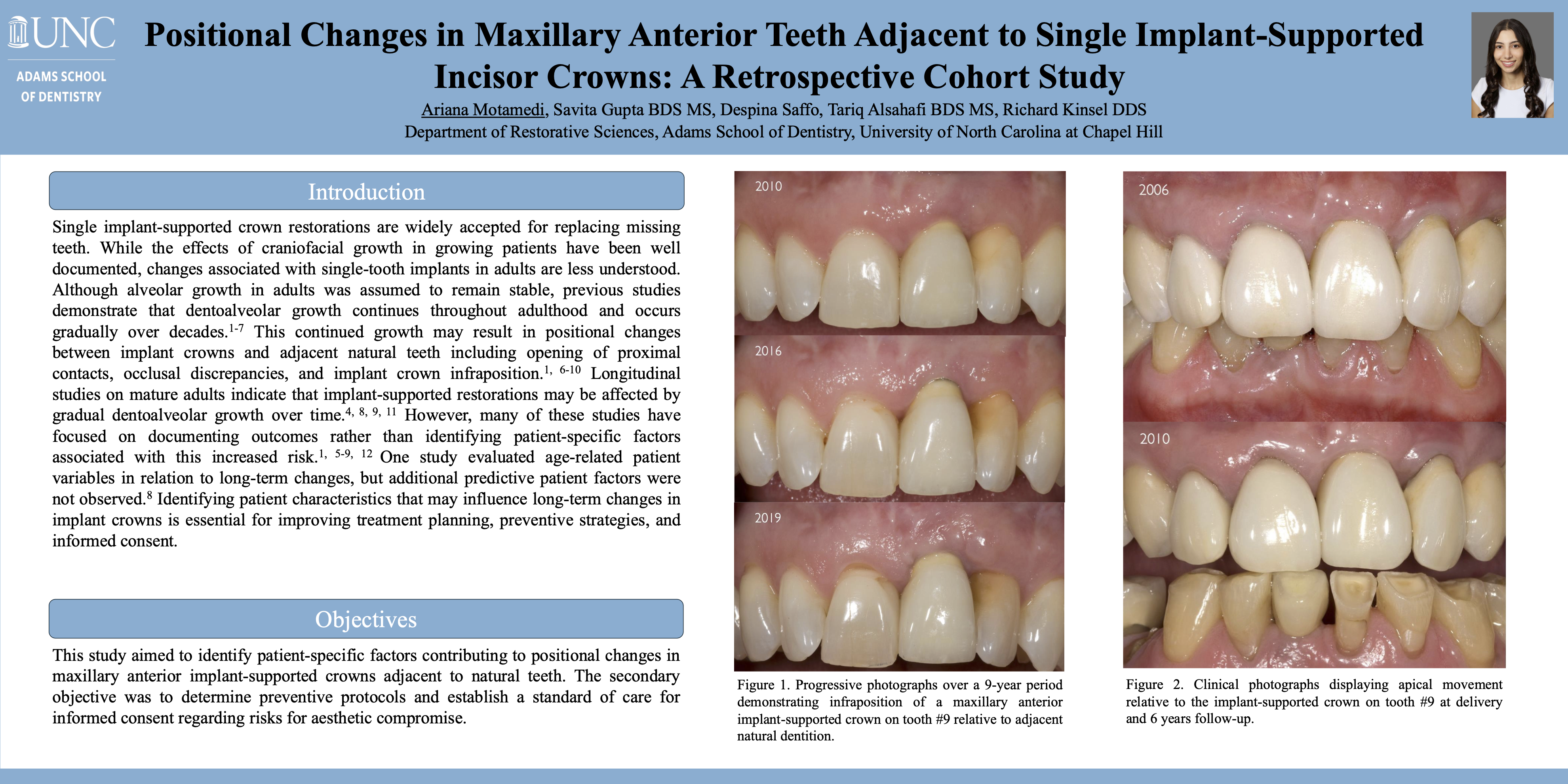 Thumbnail for Positional Changes in Maxillary Anterior Teeth Adjacent to Single Implant-supported Incisor Crowns: A Retrospective Cohort Study