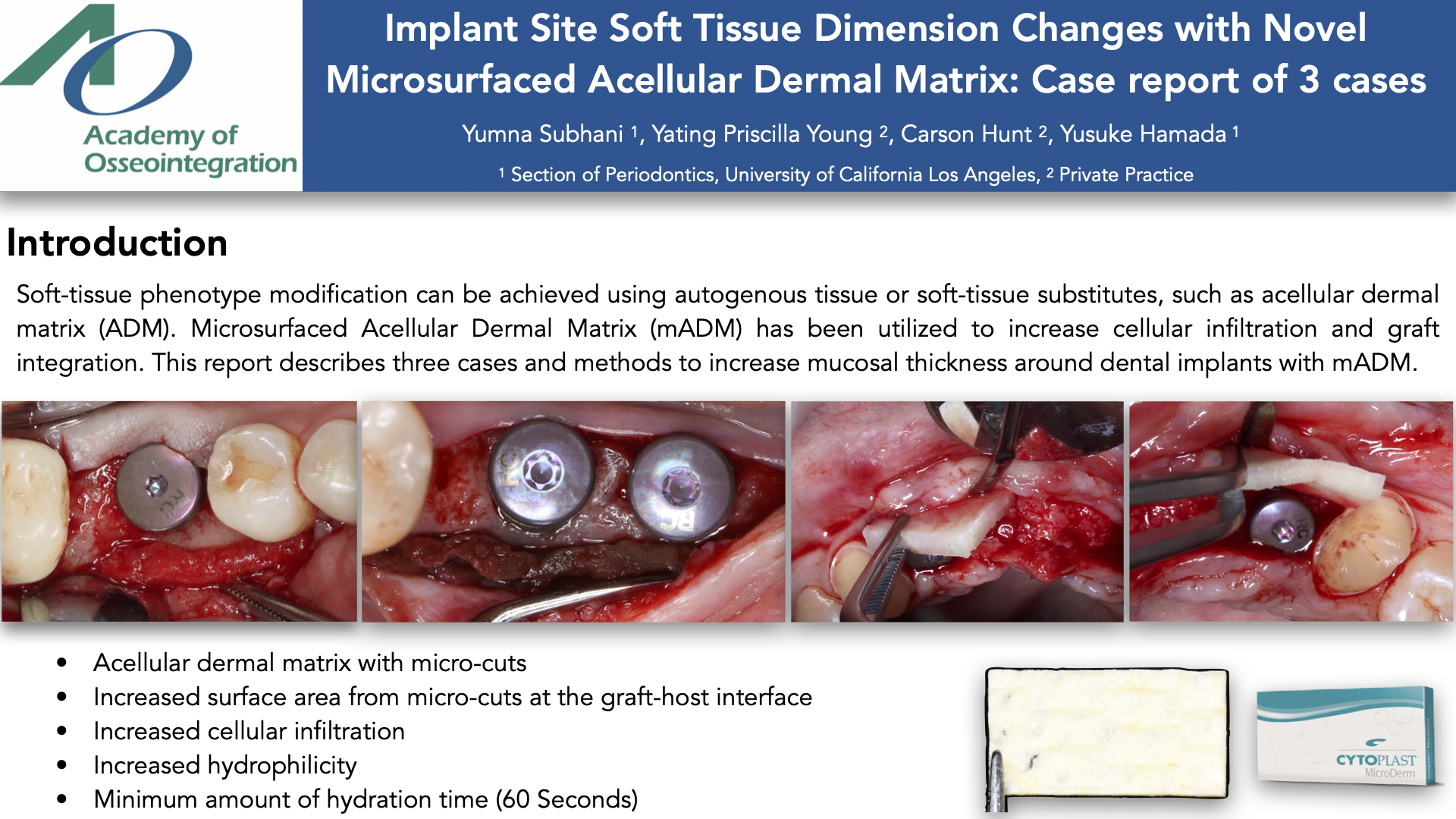 Thumbnail for Implant Site Soft Tissue Dimensional Changes With Novel Microsurfaced Acellular Dermal Matrix: Case Report of Three Cases